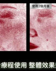 PDRN植萃舒緩修護精華PHYTO CORRECTIVE PDRN SERUM PDRN(30ml/55ml)