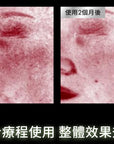 PDRN植萃舒緩修護精華PHYTO CORRECTIVE PDRN SERUM PDRN(30ml/55ml)
