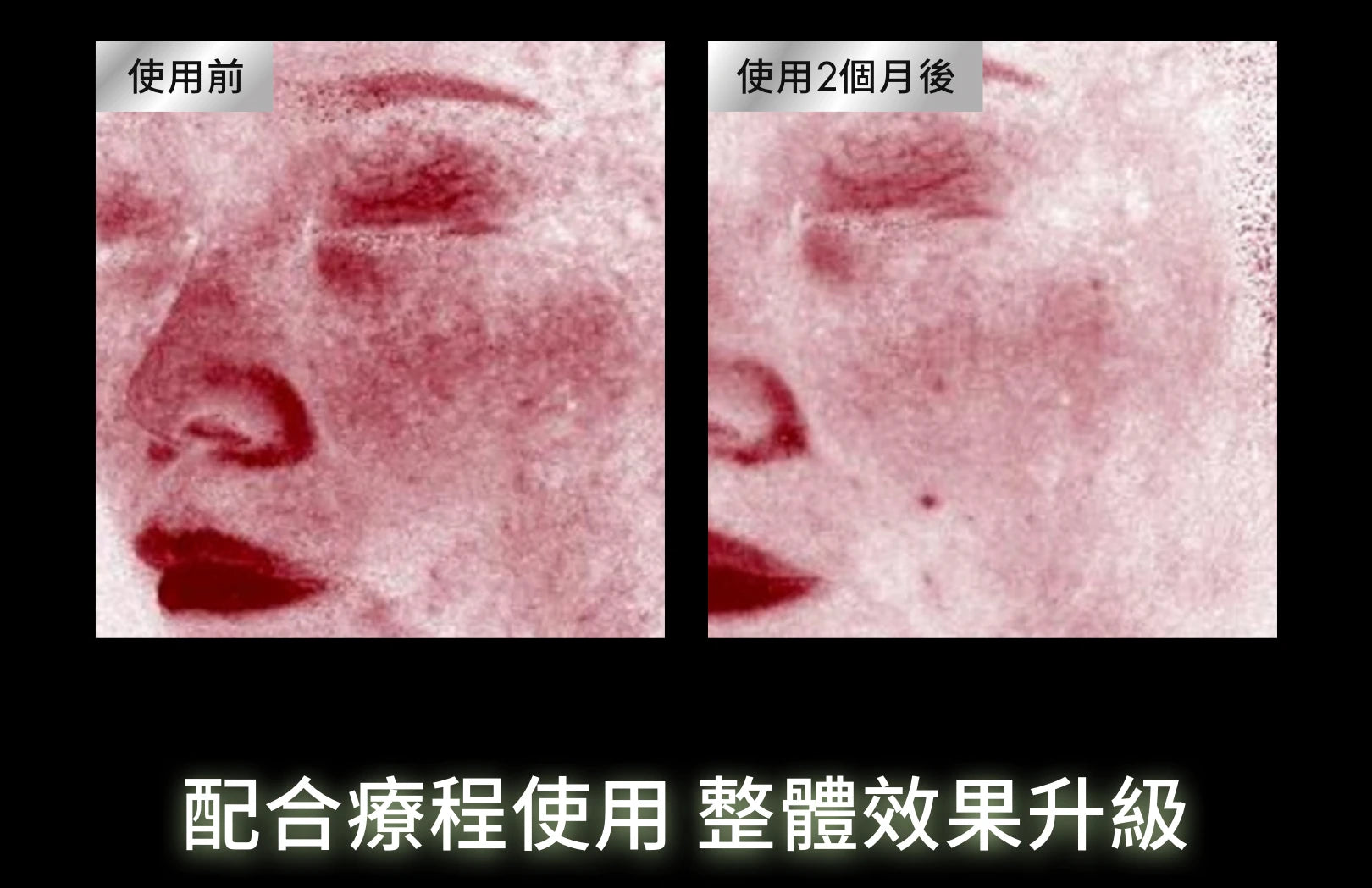 PDRN植萃舒緩修護精華PHYTO CORRECTIVE PDRN SERUM PDRN(30ml/55ml)