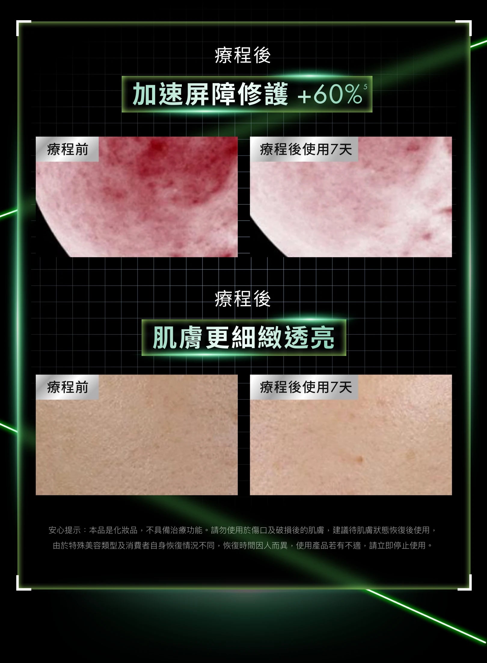 PDRN植萃舒緩修護精華PHYTO CORRECTIVE PDRN SERUM PDRN(30ml/55ml)