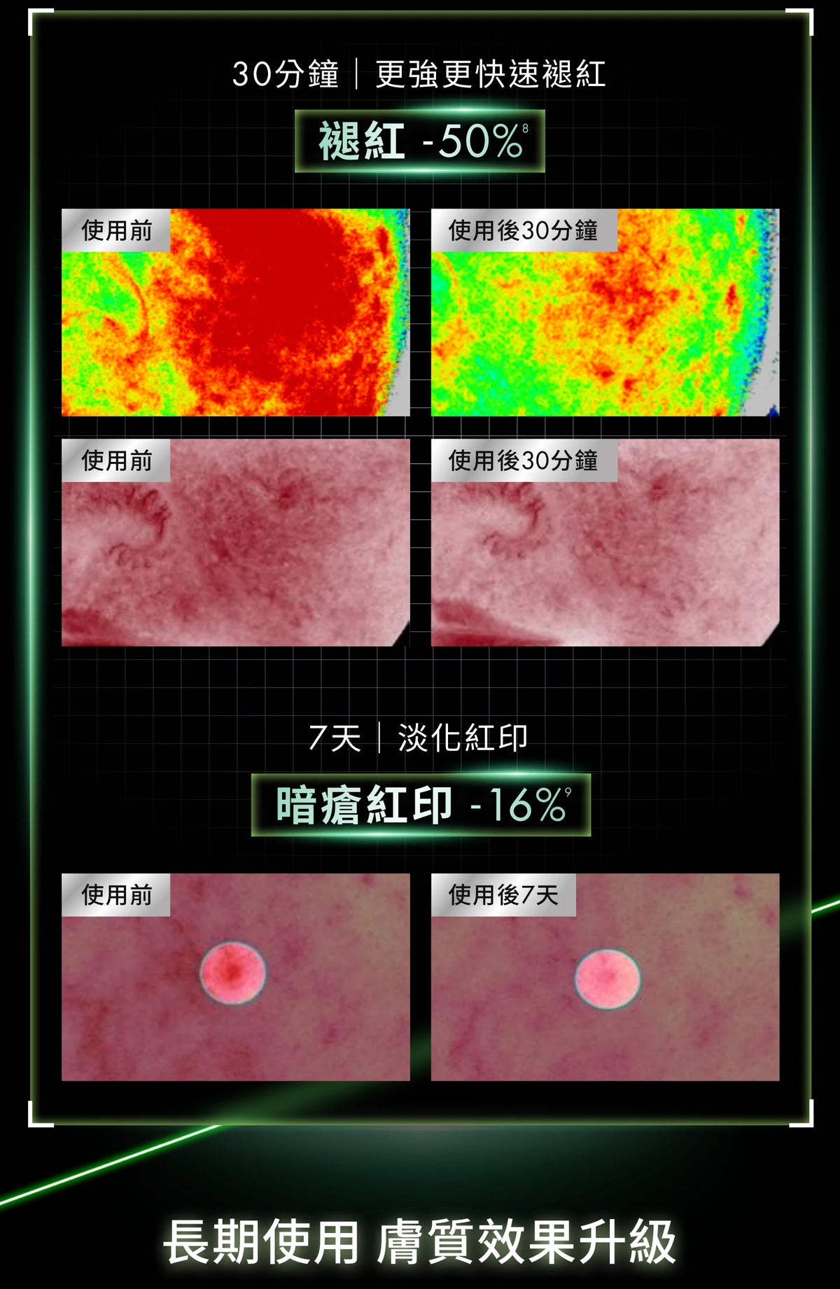PDRN植萃舒緩修護精華PHYTO CORRECTIVE PDRN SERUM PDRN(30ml/55ml)