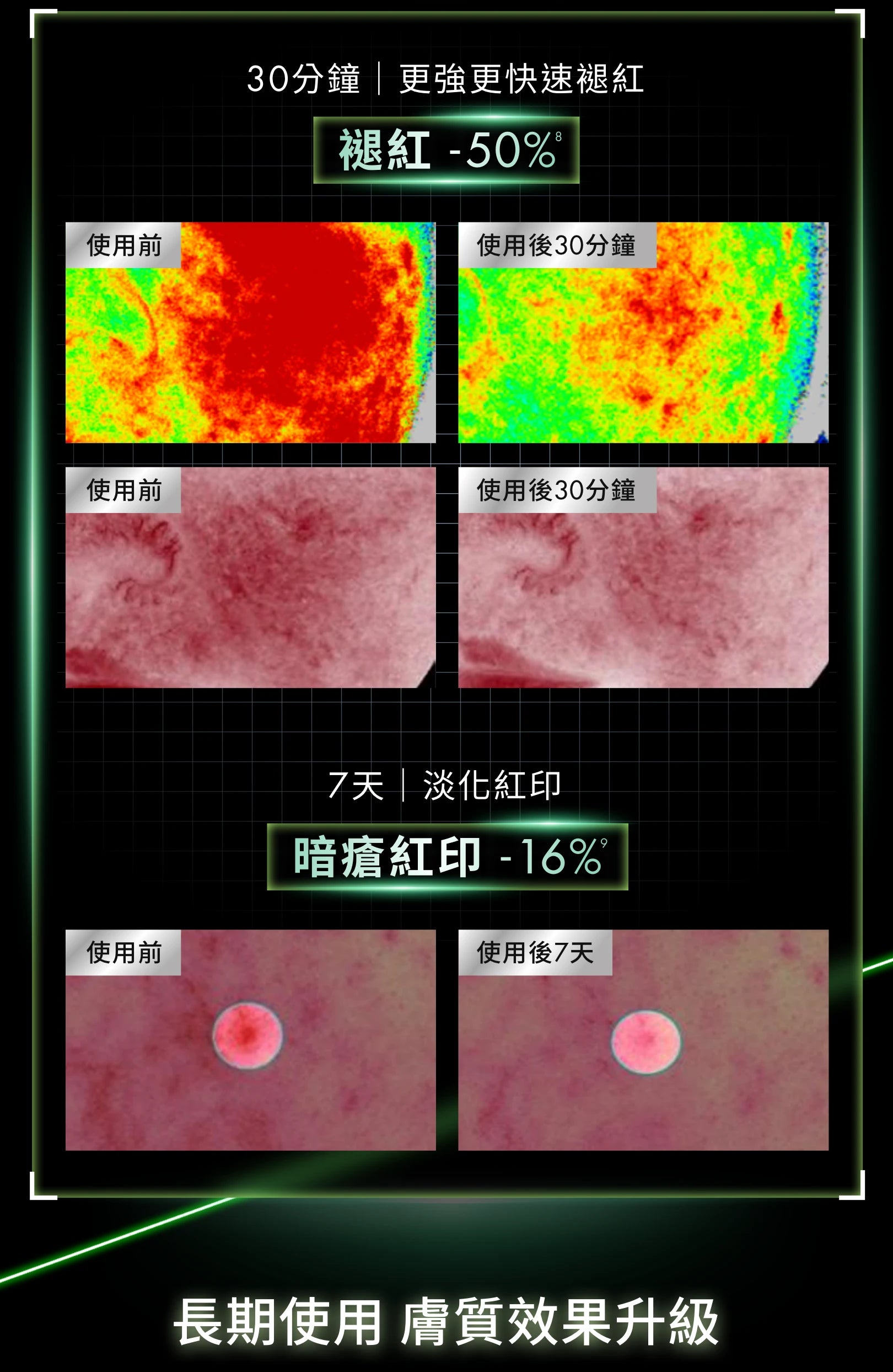 PDRN植萃舒緩修護精華PHYTO CORRECTIVE PDRN SERUM PDRN(30ml/55ml)